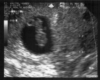 2002-0501 First-Ultrasound